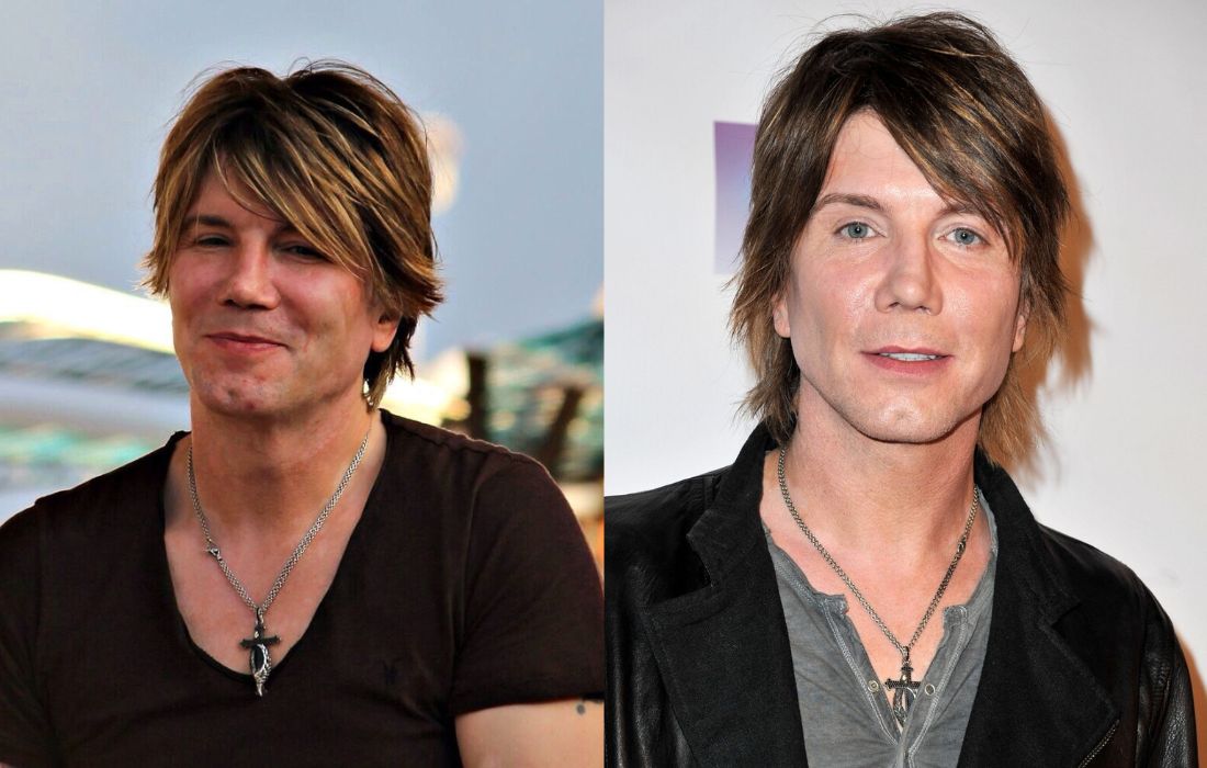 John Rzeznik Plastic Surgery Goo Goo Dolls Lead Singer Plastic Surgery